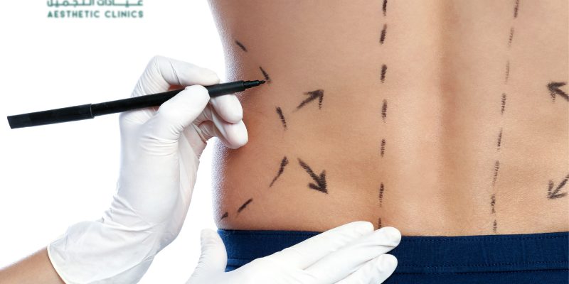 Best Plastic surgery in Sharjah